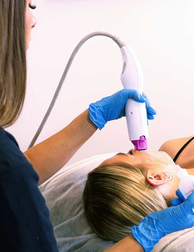 thermage face and neck